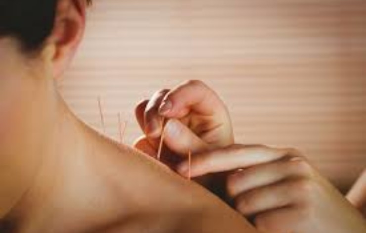 Five Reasons Acupuncture Is Good For You